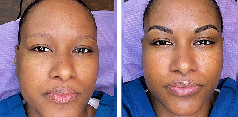 Combination Microblading and Ombre Brow Treatment by Seraphim