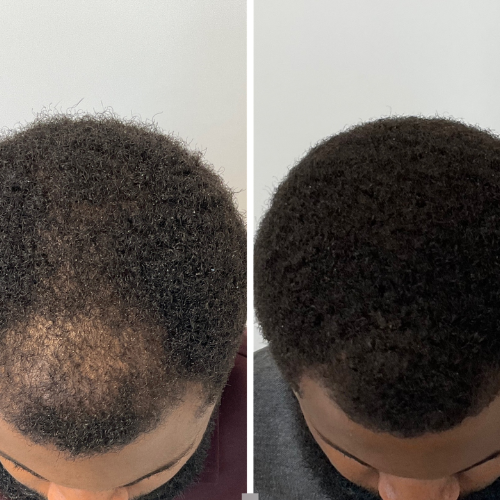 Hair & Scalp Care Consultations