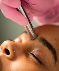 Microdermabrasion Facial - Seraphim Beauty