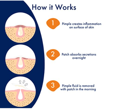 PanOxyl PM Overnight Spot Patches - Seraphim Beauty