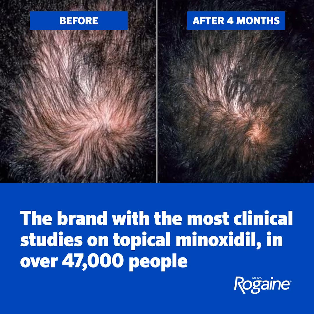 Rogaine Minoxidil Men’s Hair Regrowth Treatment