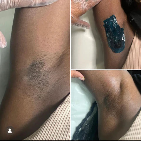 Underarm Wax - Seraphim beauty