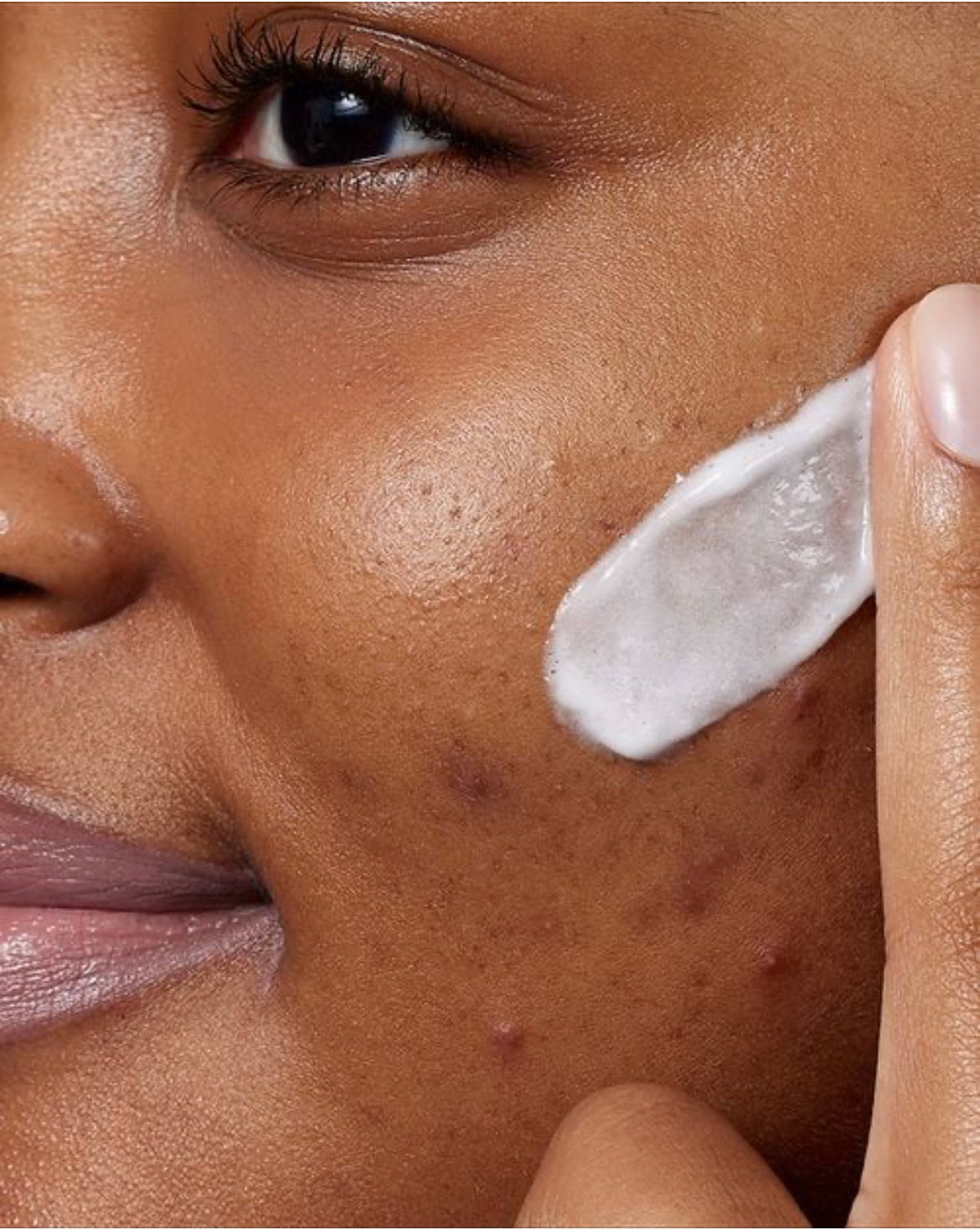 CeraVe Acne Foaming Cream Wash - Seraphim Beauty