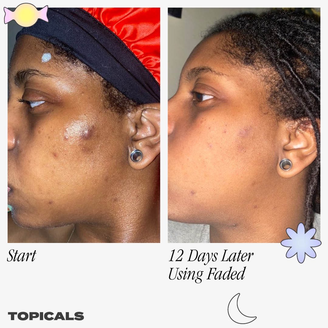 Topicals Faded Brightening and Clearing Serum - Seraphim Beauty